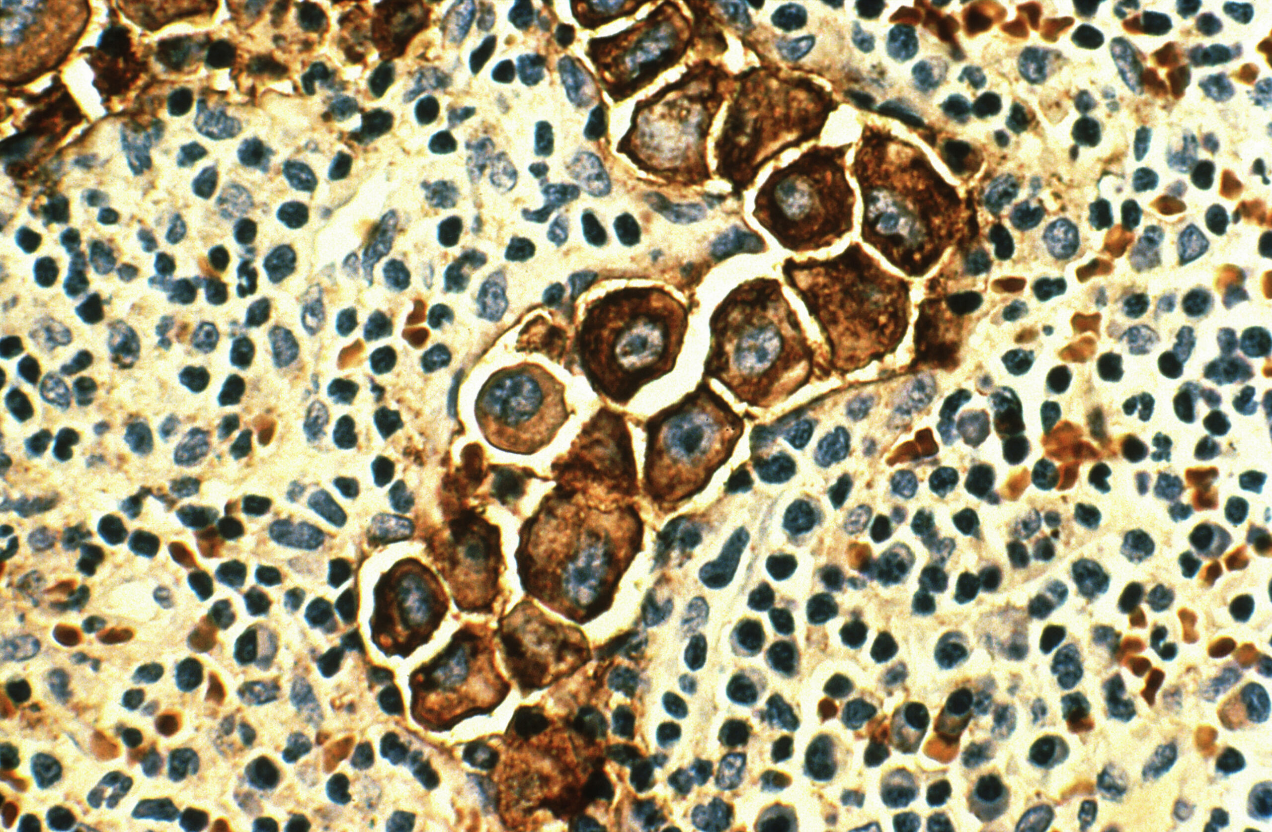IHC tissue slide under microscope — HTS Labs Ireland