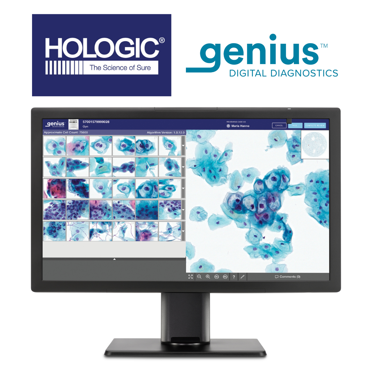 Hologic-Genius-Cytology Hologic genius cytology testing